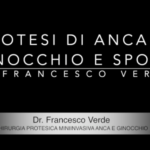 protesi-sport-francesco-verde